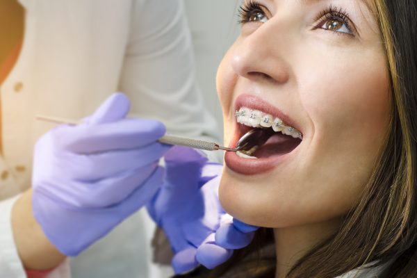 Beneficios de la Ortodoncia en adultos