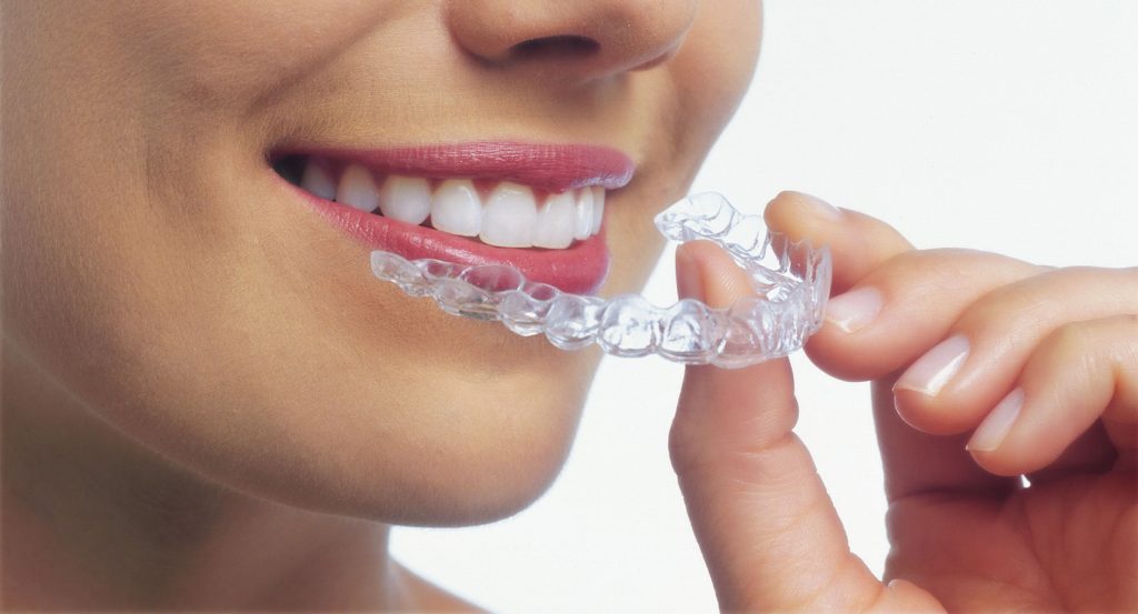 ortodoncia Invisalign
